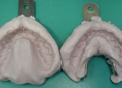 стоматологических альгината натрия класс