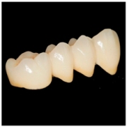 Dental Porcelain fused to Titanium alloy crown(PFM)