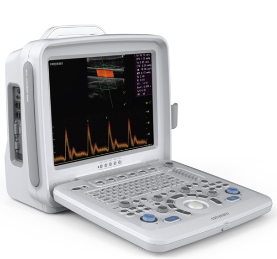 Canyearn color doppler ultrasound scanner for human and vets