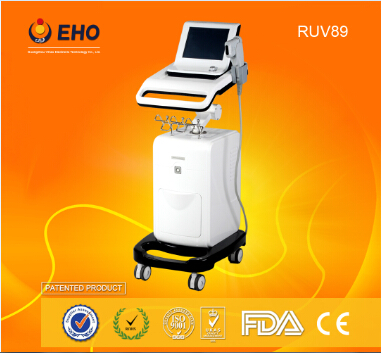 2015 newest high intensity focused ultrasound hifu RUV89