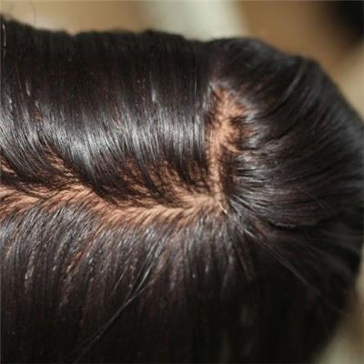 Silk Base Closure With Baby Hair