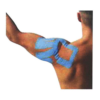 New Kinesiology Patch For SHOULDER
