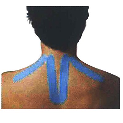 New Kinesiology Patch For NECK