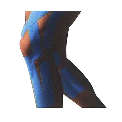 New Kinesiology Patch For FULL KNEE