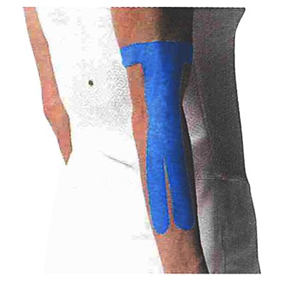 New Kinesiology Patch For ELBOW