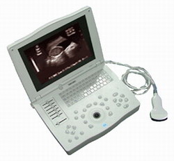 Laptop ultrasound scanner RSD-RP6A(HUMAN)