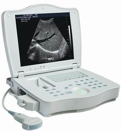Full Digital Laptop Ultrasound Scanner RSD-RP6A Plus(HUMAN)