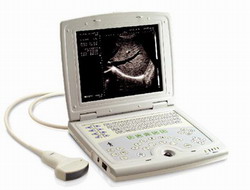Full digital veterinary Laptop ultrasound scanner RSD-RD8B(VET)