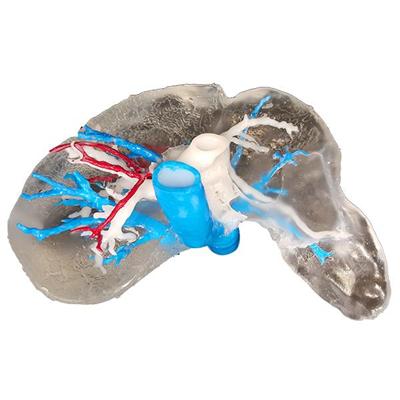Liver Model Life Size with Tumor and Hepatic Artery for Medical Students/3D Liver Model/ Body Organs
