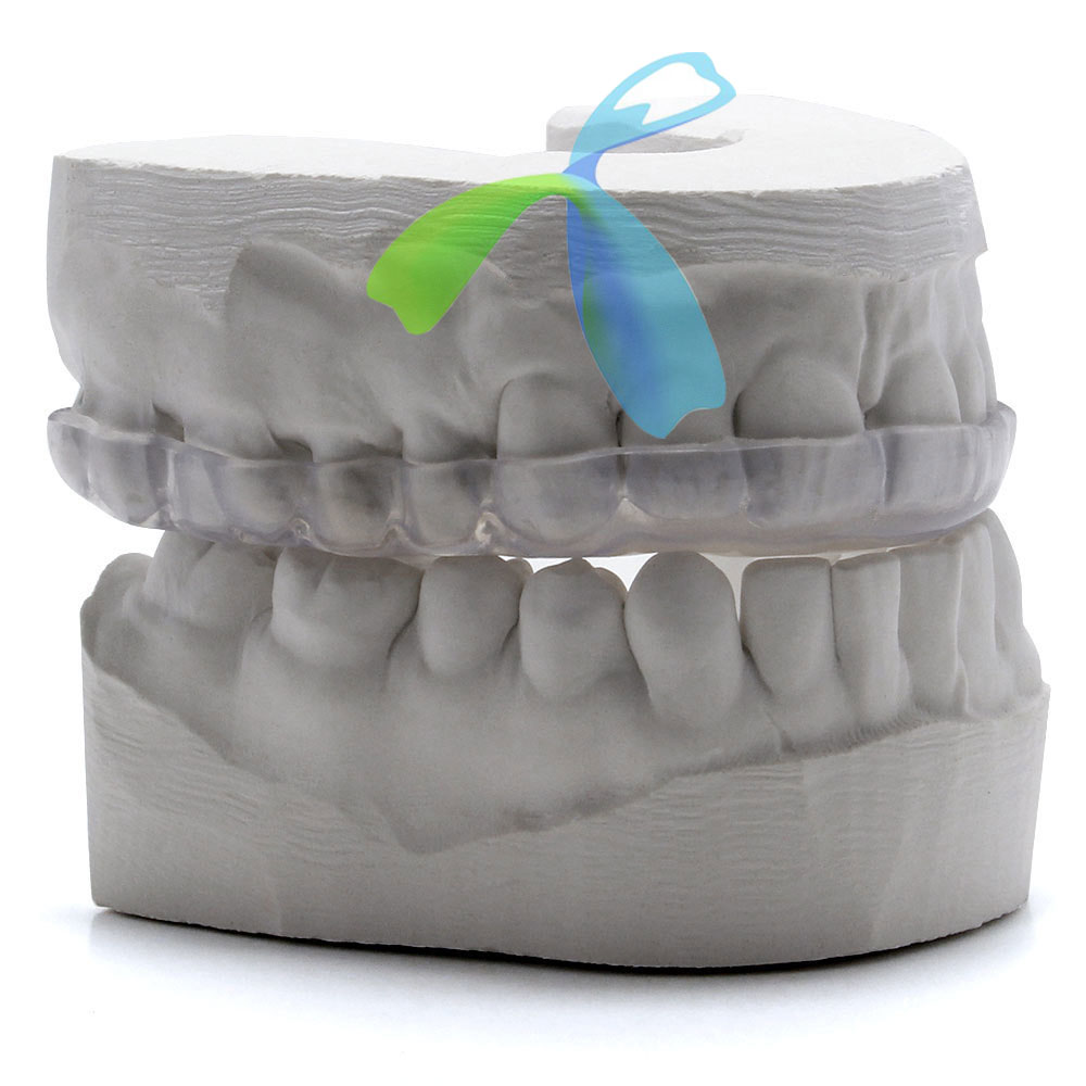 Mouth Night Guard/Splint hard/soft with Clear or colored outsourcing from China