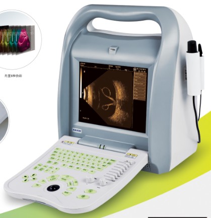 Full digital ophthalmic A/B ultrasound scanner  ODU8