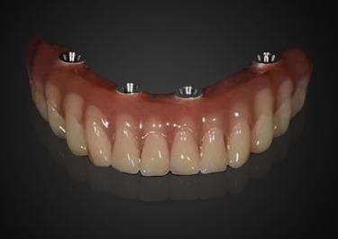 China Orthodontic industry leading brand