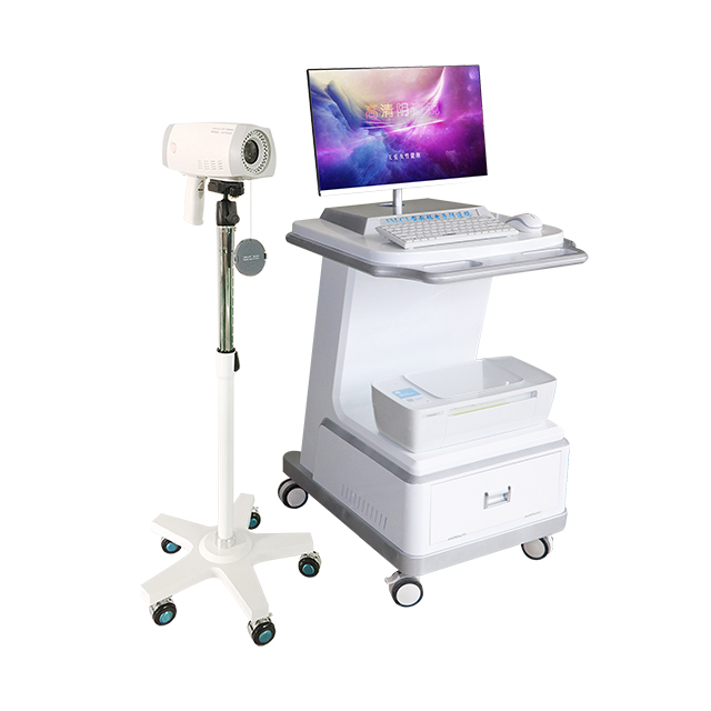 Colposcope Digital Imaging System Gynecological Colposcopy Camera Vaginal Equipment