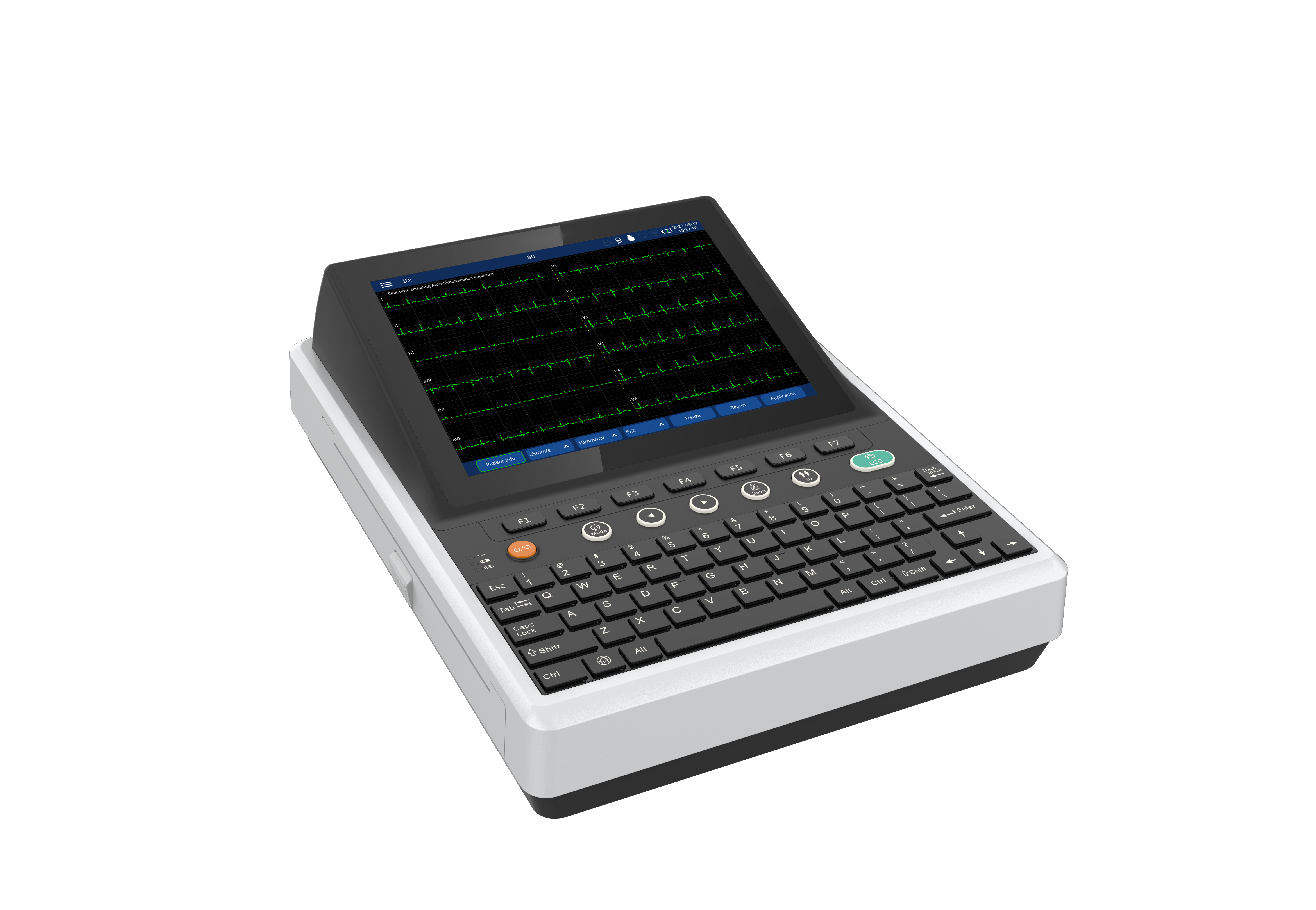 Factory Wholesale Custom Medical High Accuracy Electrocardiogram Ecg Machine