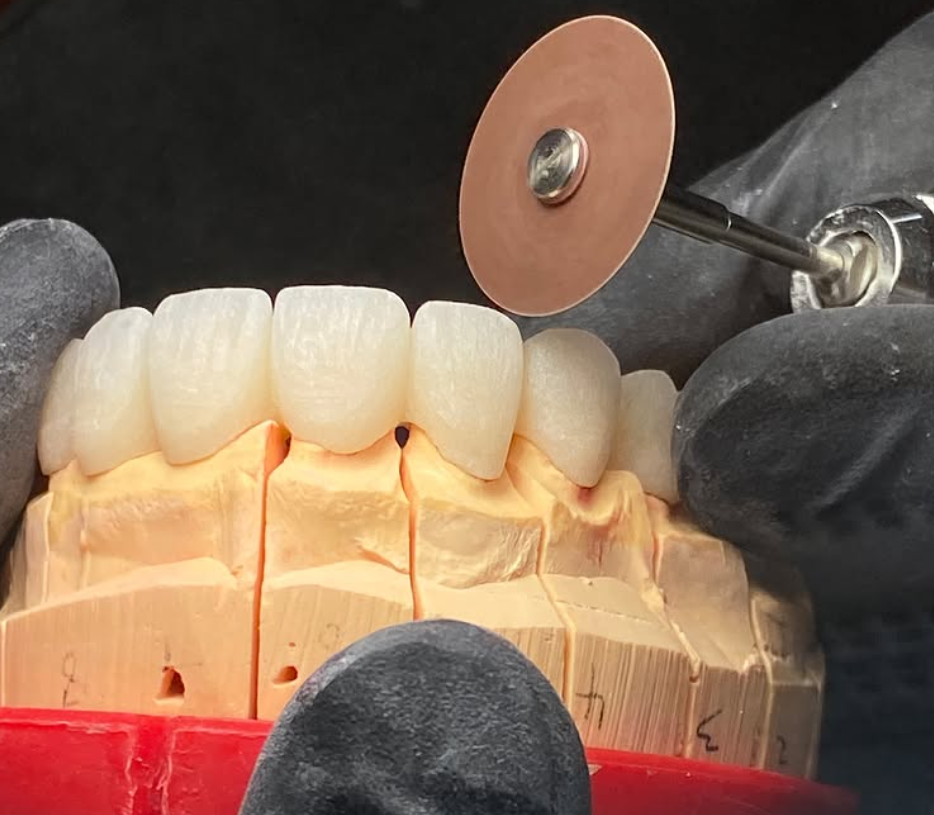 Shenzhen Jiusheng denture Technology Co., LTD