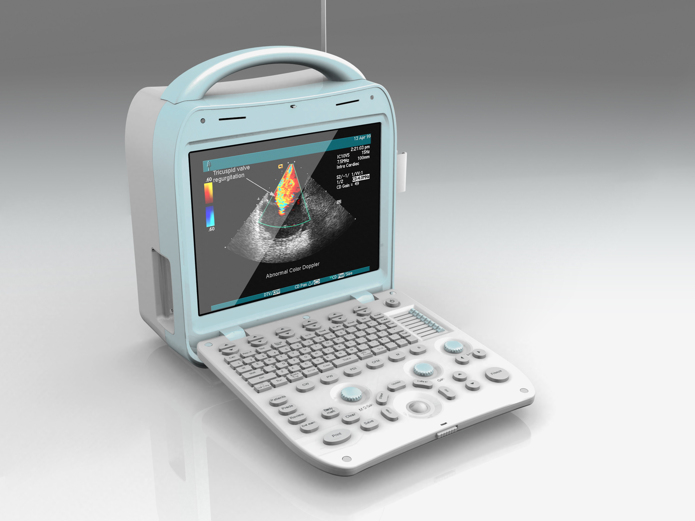 Portable Ultrasound system 15  inch color doppler scanners.
