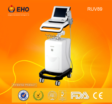 RUV89 высокого качества подтяжка лица HIFU уменьшая оборудование