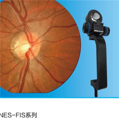 Retinal Imaging System For Slit Lamp
