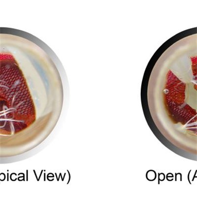 Mitral Valves with Transparent Silicone 3D Printing for Heart Valve Surgery/Mitral Vavle Repair/Surgery Simulator
