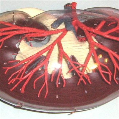 1:1 Kidney Model Transparent Soft with Stone and Renal Artery /3D Kidney Model/Anatomical Model
