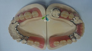 Partial/Full Dentsply pink acrylic denture, Lucitone 199 acrylic with Yamahachi teeth
