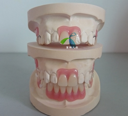 TCS Unbreakable Valplast, Flexible Partial denture base from Chinese Dental outsourcing lab