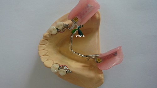 3D Digital stl files with scanning systems CAD/CAM Technology services FuTeng denture