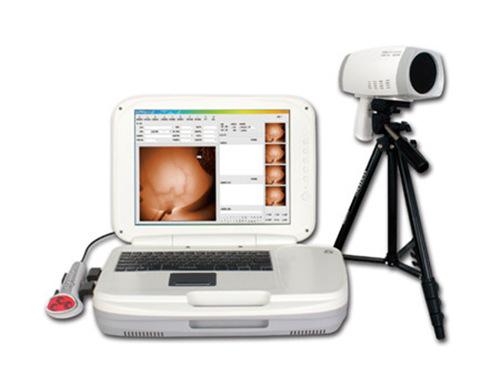 Full HD Infrared Mammary Gland Examination System