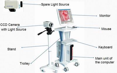 Video colposcope for digital 