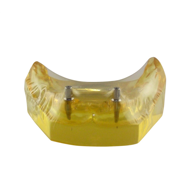 Dental Implant Practice Models