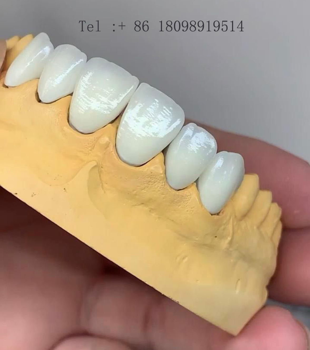 Zirconia Dental Crown | Zirconia Dental Lab in