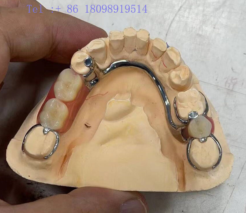  Crown Bridge Zirconia China Dental