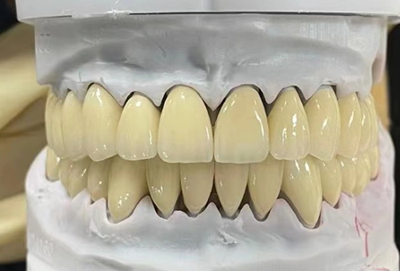 Manufacturer direct sales invisible denture resin tooth metal support pure titanium cobalt chromium stainless steel movable dentures