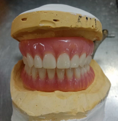 Full and half mouth movable denture glue attached denture glue support denture elderly removable removable denture full mouth denture