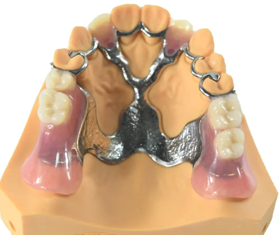 3d printing laser metal partial denture teeth