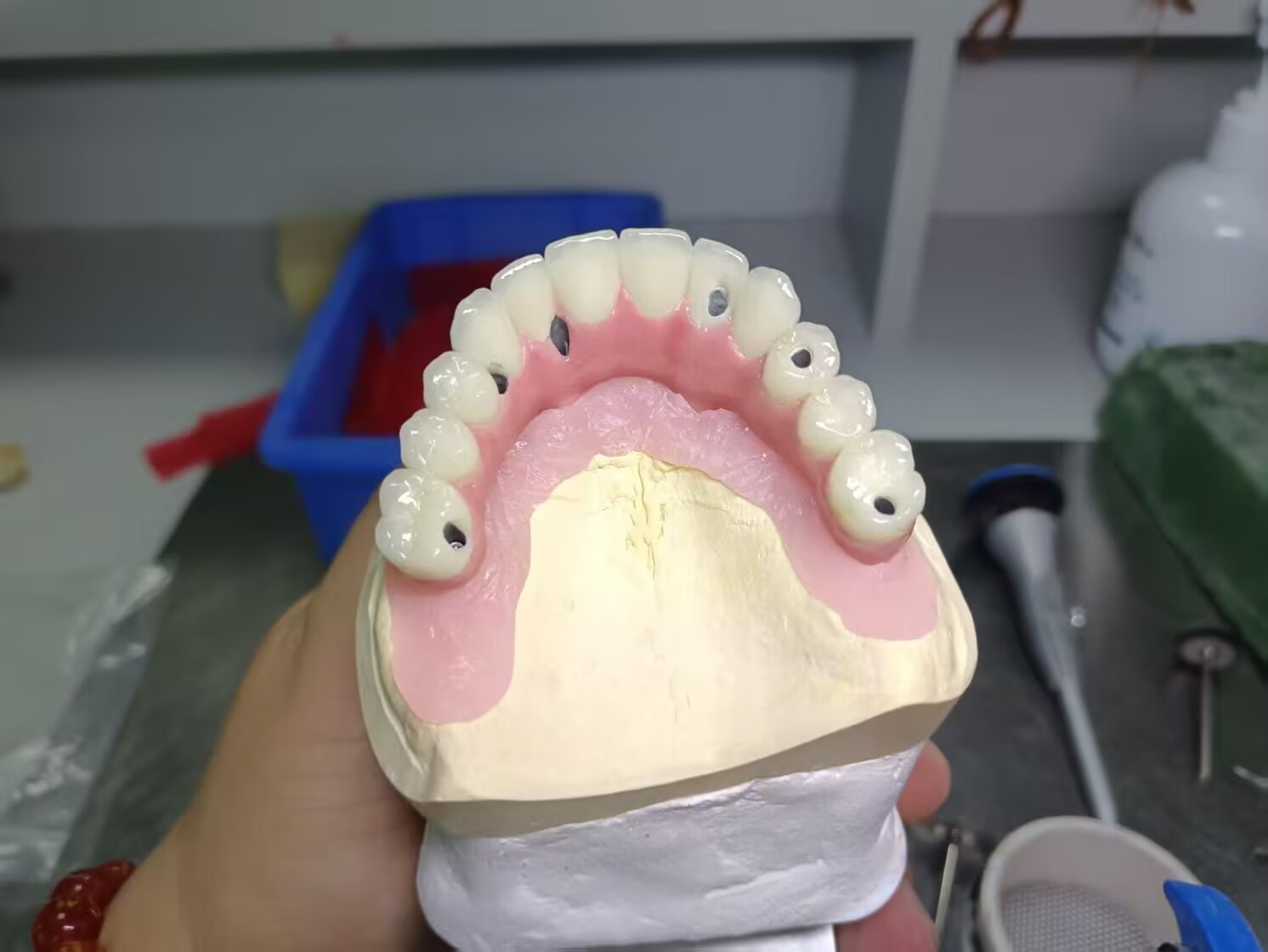 Metal Composite Bridge - China Dental Lab Good Quality And Good Esthetics