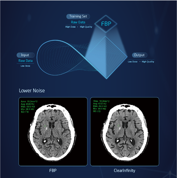 128 Slice CT Scanner