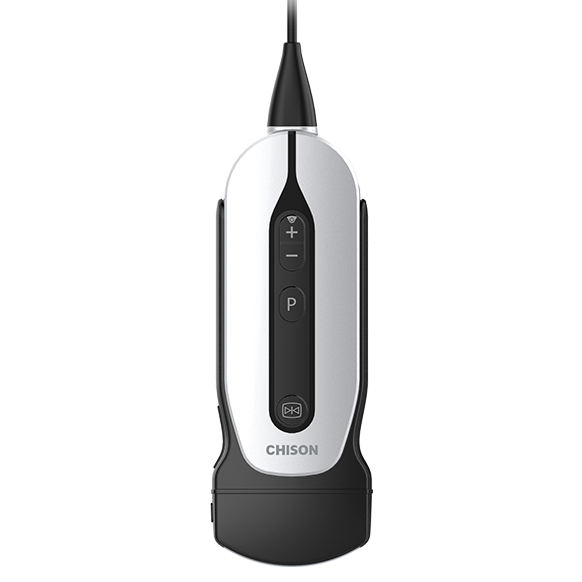 portable ultrasound machine for pregnancy