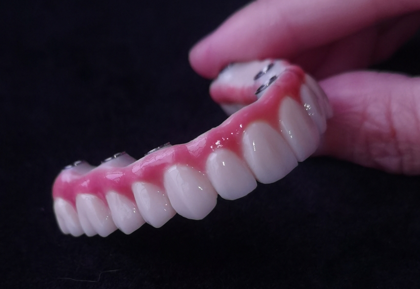China implants dental lab