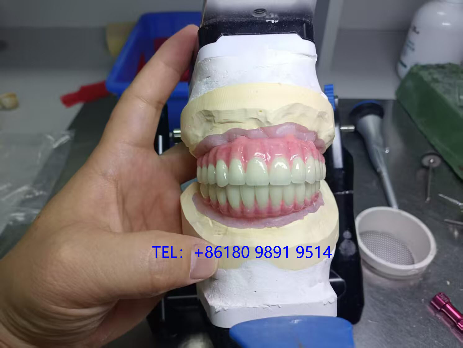 All-Zirconia Screw-Retained Bridges-Myy Dentallab