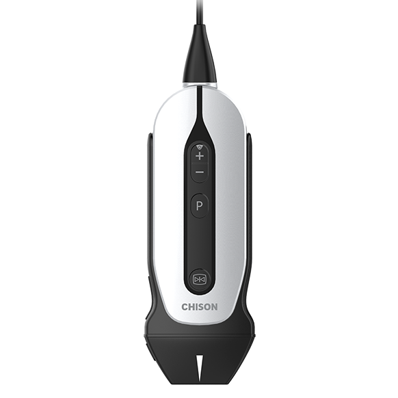 mini ultrasound machine