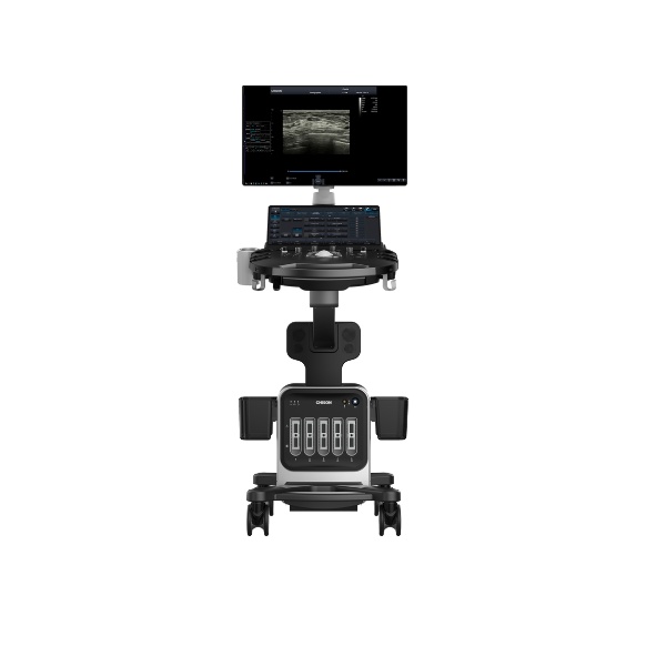 SonoPort Portable Cart-based Ultrasound