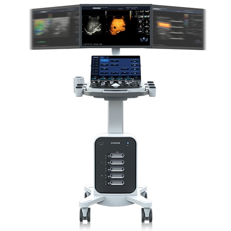 SonoMax 7 ultrasound
