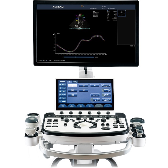 XBit 90 Ultrasound