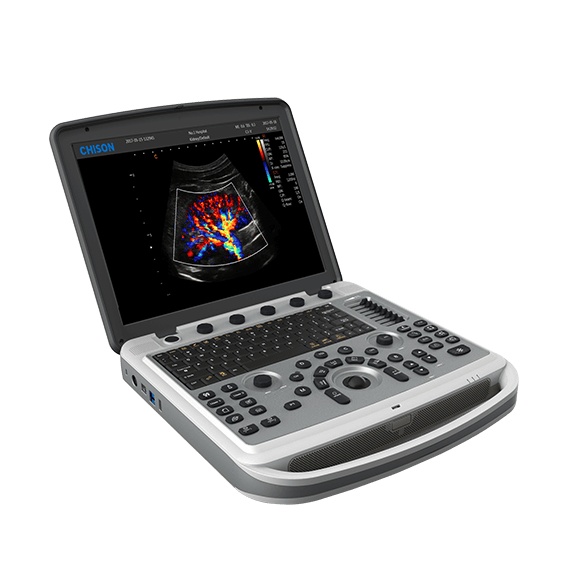CHISON SonoBook 6 Portable Ultrasound